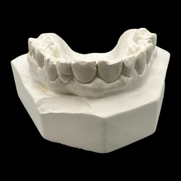 Vintage Plaster Dental Mold - Teeth Tooth Mold - Creepy Oddity - Dental Oddities - Picture 13 of 16